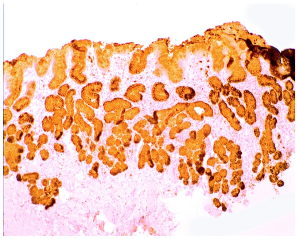 a microscope image of lysozyme enzymes