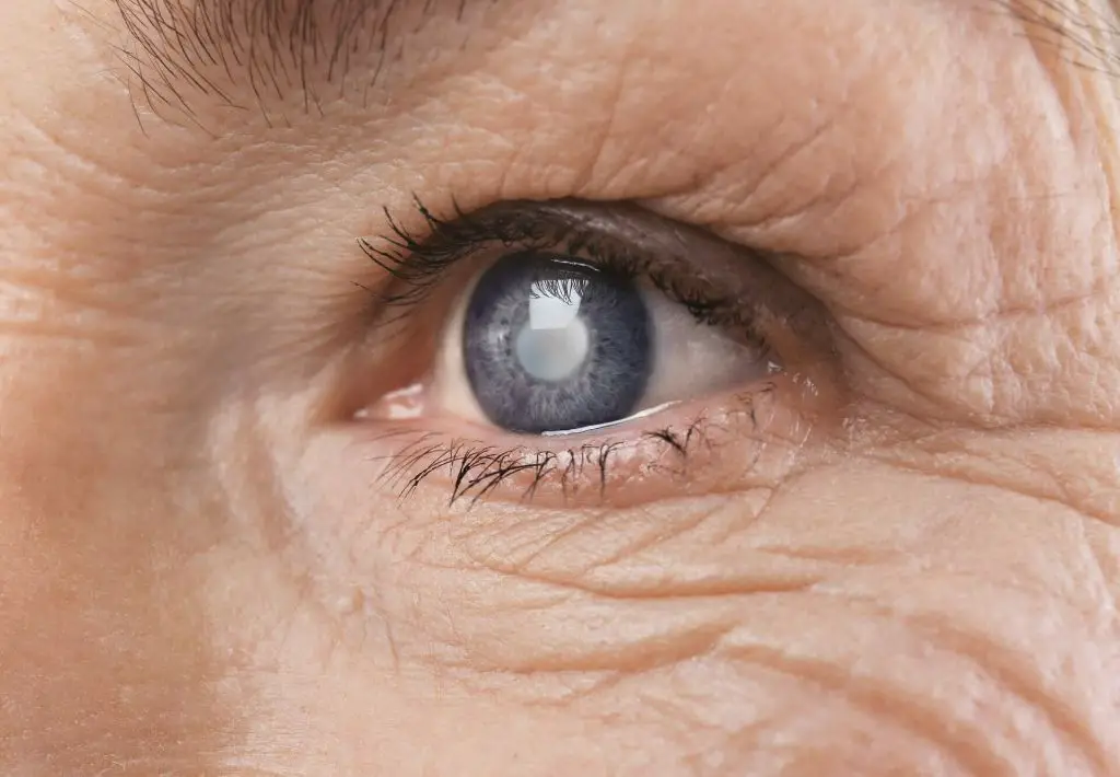 a person undergoing cataract surgery to restore vision