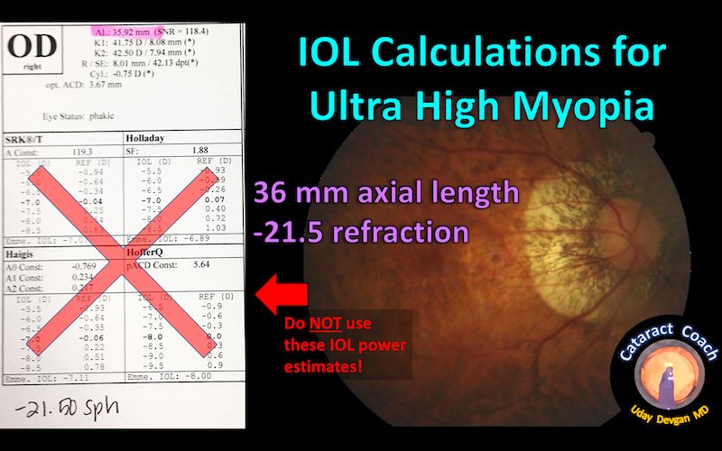 advanced devices improve iol power calculation for better vision