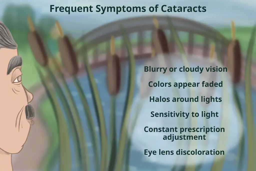common symptoms of cataracts include blurry vision and glare sensitivity