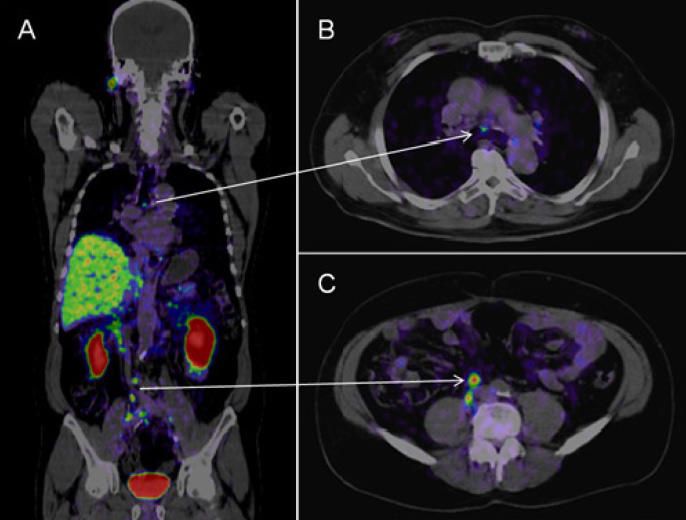 ct scan images showing a tumor