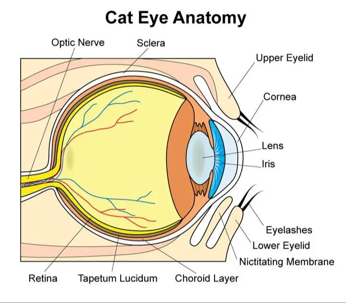 diagram of cataract in the eye