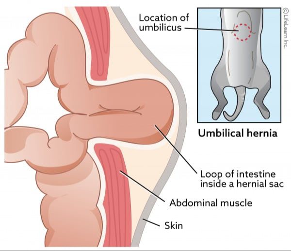 diagram of umbilical cord anatomy