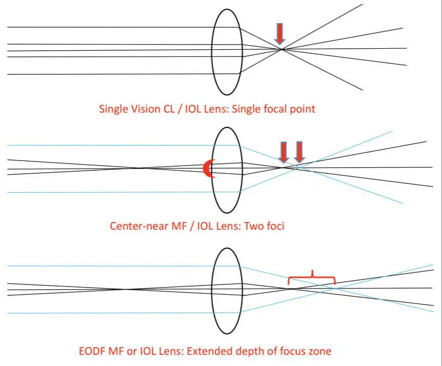 monofocal lens diagram 