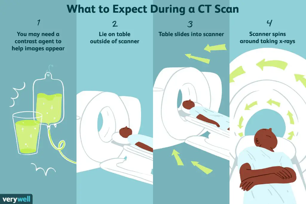 risks outweigh benefits for most ct scans