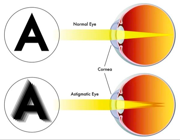 someone reviewing the benefits of different types of lenses